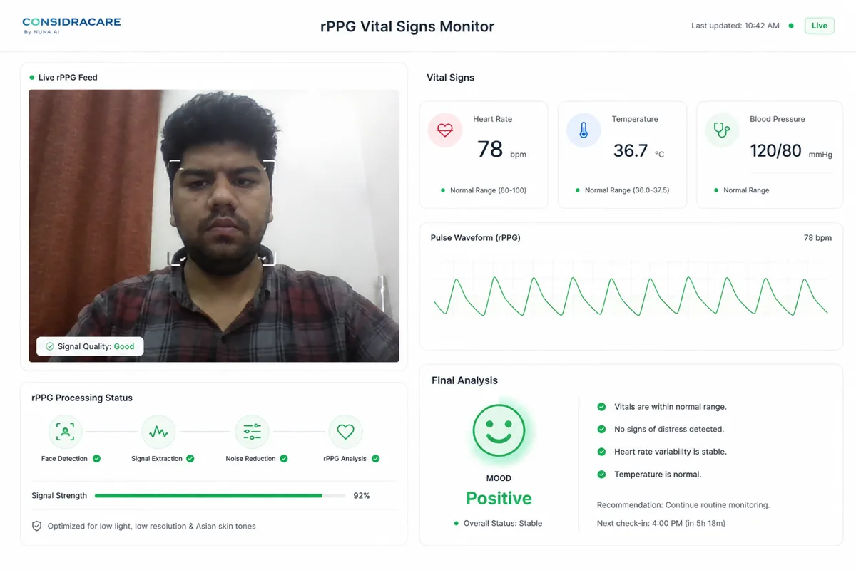 Demo of the rPPG bio-analytics vision system built for ConsidraCare